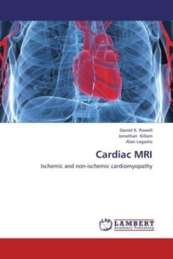 Cardiac MRI