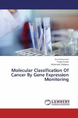 Molecular Classification Of Cancer By Gene Expression Monitoring