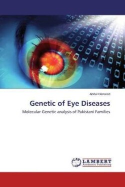 Genetic of Eye Diseases