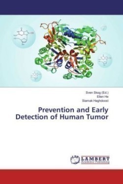 Prevention and Early Detection of Human Tumor | Megabooks SK