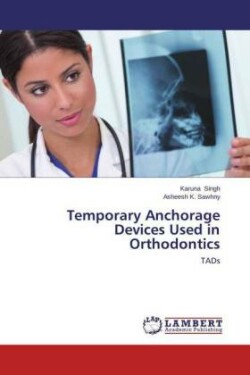 Temporary Anchorage Devices Used in Orthodontics