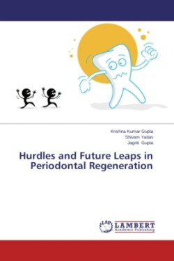 Hurdles and Future Leaps in Periodontal Regeneration