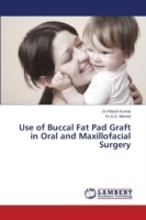 Use of Buccal Fat Pad Graft in Oral and Maxillofacial Surgery