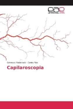 Capilaroscopia