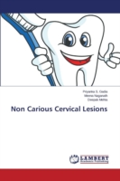 Non Carious Cervical Lesions