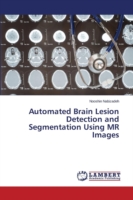 Automated Brain Lesion Detection and Segmentation Using MR Images
