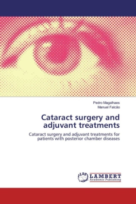 Cataract surgery and adjuvant treatments