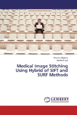 Medical Image Stitching Using Hybrid of SIFT and SURF Methods