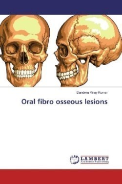 Oral fibro osseous lesions