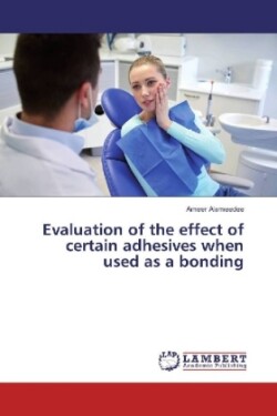 Evaluation of the effect of certain adhesives when used as a bonding