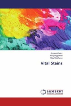 Vital Stains