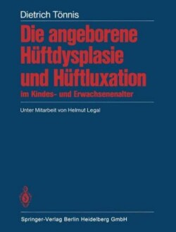 Die angeborene Hüftdysplasie und Hüftluxation im Kindes- und Erwachsenenalter