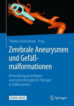 Zerebrale Aneurysmen und Gefäßmalformationen, m. 1 Buch, m. 1 E-Book