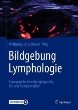 Bildgebung Lymphologie