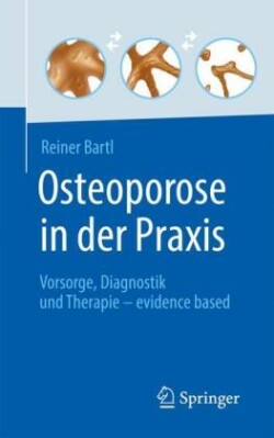 Osteoporose in der Praxis