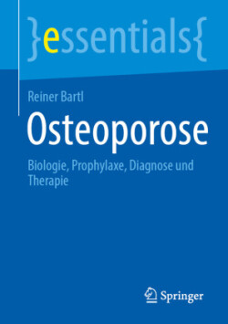 Osteoporose