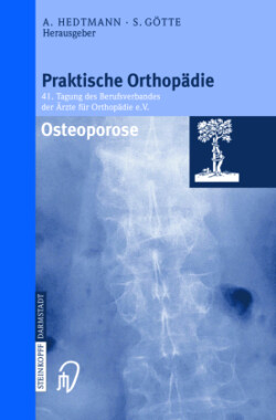 Osteoporose