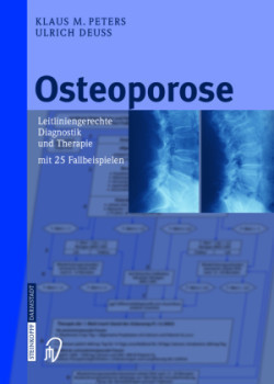 Osteoporose