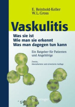 Vaskulitis