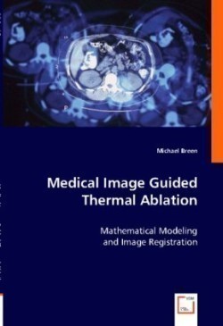 Medical Image Guided Thermal Ablation