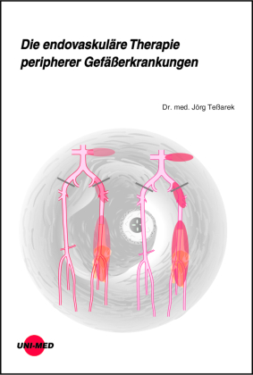 Die endovaskuläre Therapie peripherer Gefäßerkrankungen