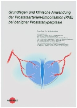 Grundlagen und klinische Anwendung der Prostataarterien-Embolisation (PAE) bei benigner Prostatahyperplasie