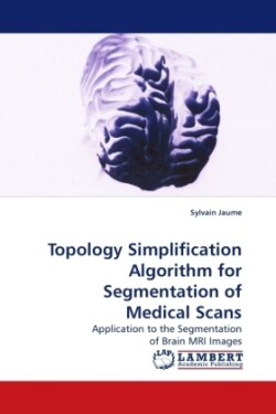 Topology Simplification Algorithm for Segmentation of Medical Scans