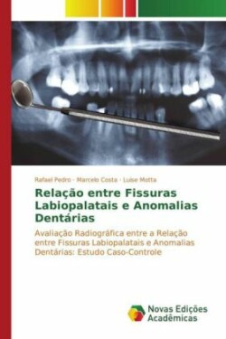 Relação entre Fissuras Labiopalatais e Anomalias Dentárias