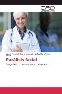 Parálisis facial