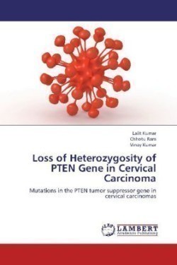 Loss of Heterozygosity of Pten Gene in Cervical Carcinoma