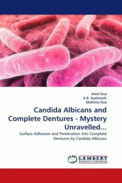 Candida Albicans and Complete Dentures - Mystery Unravelled...