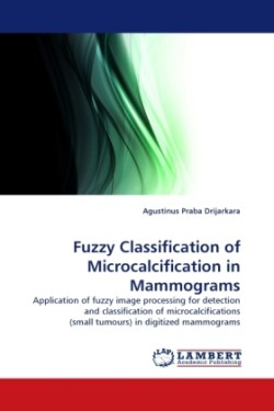 Fuzzy Classification of Microcalcification in Mammograms