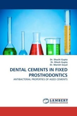 Dental Cements in Fixed Prosthodontics