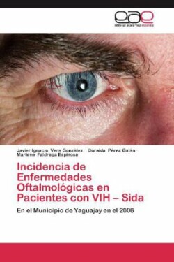 Incidencia de Enfermedades Oftalmologicas En Pacientes Con Vih - Sida