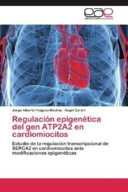 Regulacion Epigenetica del Gen Atp2a2 En Cardiomiocitos