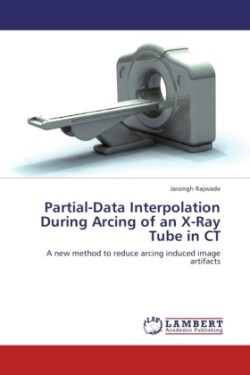 Partial-Data Interpolation During Arcing of an X-Ray Tube in CT
