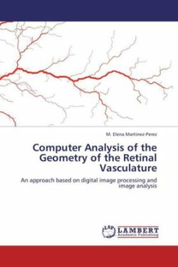 Computer Analysis of the Geometry of the Retinal Vasculature