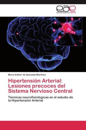 Hipertensión Arterial