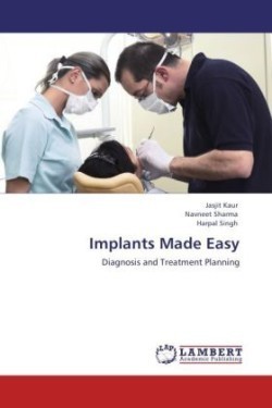 Implants Made Easy