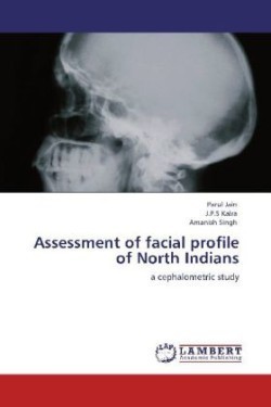 Assessment of facial profile of North Indians