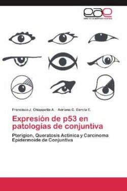 Expresion de P53 En Patologias de Conjuntiva