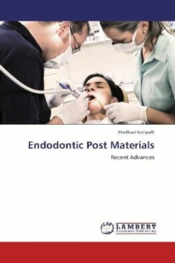 Endodontic Post Materials