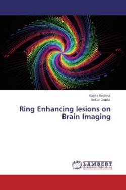 Ring Enhancing Lesions on Brain Imaging