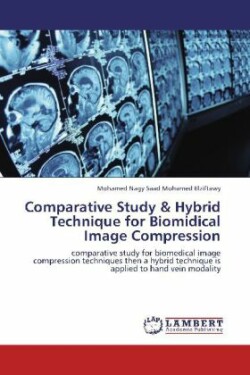 Comparative Study & Hybrid Technique for Biomidical Image Compression