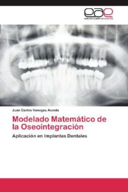 Modelado Matematico de La Oseointegracion
