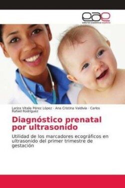 Diagnostico Prenatal Por Ultrasonido