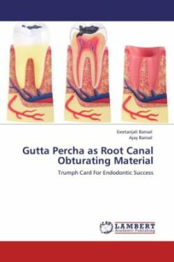 Gutta Percha as Root Canal Obturating Material