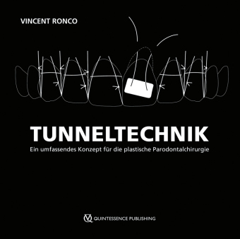 Tunneltechnik