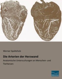 Die Arterien der Herzwand