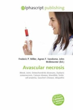 Avascular necrosis
